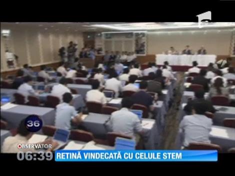 Retină vindecată cu celule stem