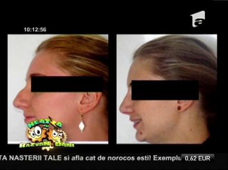 Un look de invidiat: Ce trebuie să ştii despre frumuseţea şi sănătatea nasului!