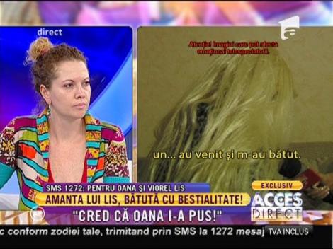 Amanta lui Lis, bătută cu bestialitate: "Cred că Oana a pus să fiu atacată!"