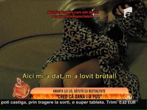 Amanta lui Lis, bătută cu bestialitate: ”Cred că Oana i-a pus!”