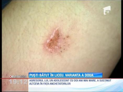 UPDATE/ Elev bătut pentru că este prea popular pe Facebook