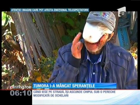 Bunicul afectat de tumora imensă, chinuit de durere