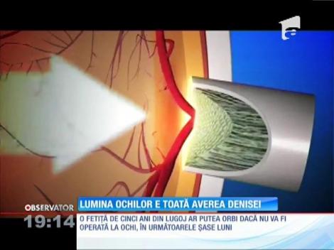 Update / Denisa, o fetiţă de 5 ani din Lugoj, riscă să-și piardă vederea