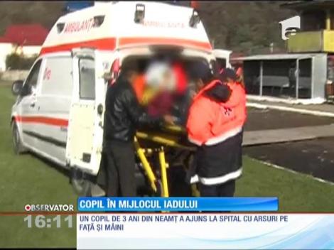 Copil de 3 ani internat cu arsuri pe față și pe mâini