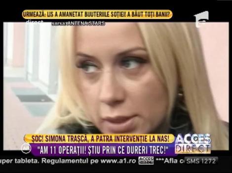 Simona Traşcă s-a operat la nas