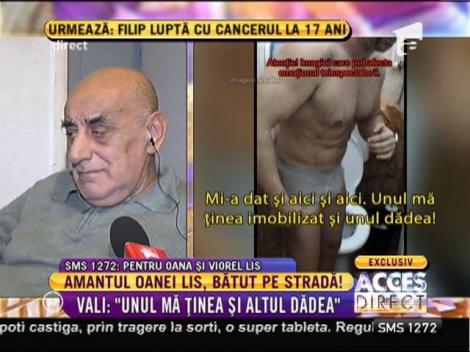 Vali, bătut pe stradă fără milă!