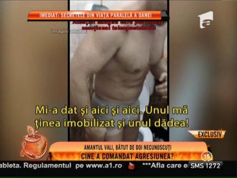 Amantul Oanei Lis, bătut de doi necunoscuţi!