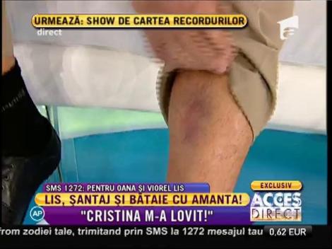 Viorel Lis, bătut de amantă!