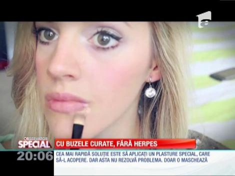 Scapă de herpes simplu şi rapid