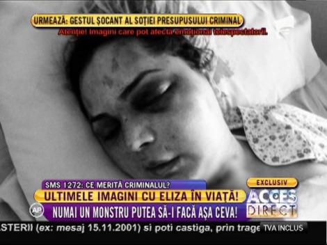 Eliza, tânăra din Alexandria, complet desfigurată! Cum arăta cu puțin timp înainte să moară! Atenție, IMAGINI ȘOCANTE!