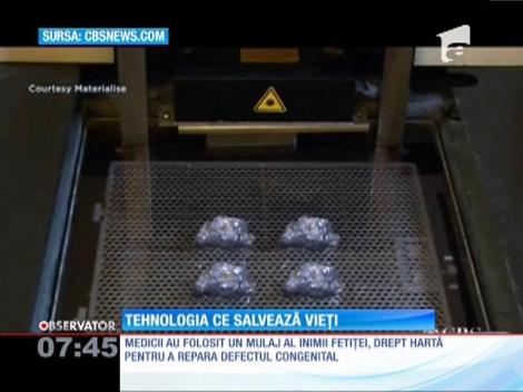 Imprimantă 3D salvează vieți