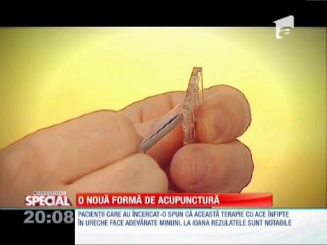 Special! Acupunctura vindecă aproape orice