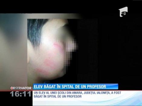 Elev băgat în spital cu maxilarul rupt de un profesor