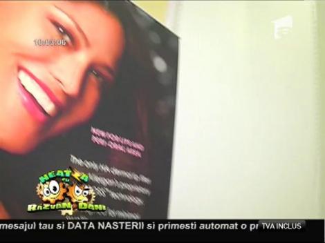 Bună dimineaţa, sănătate! Alopecia, căderea părului