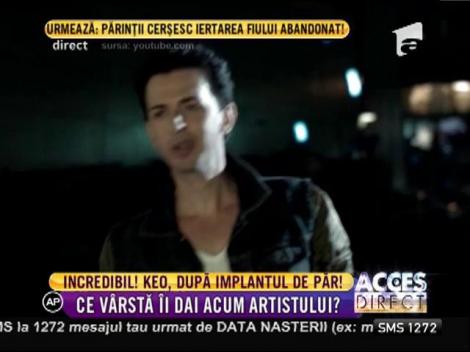 Uite cum arată Keo după implantul de păr