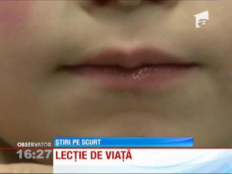 A rămas cu obrazul şi limba lipite de geamul autobuzului şcolar