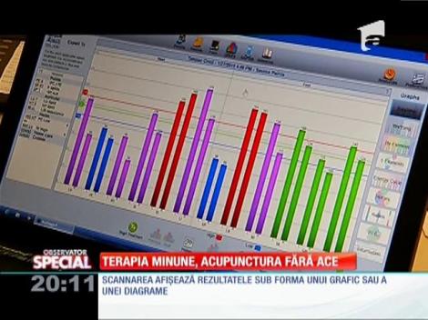 Special! Acupunctura fără ace