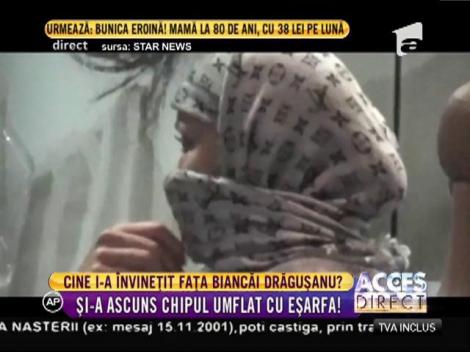 ȘOC în showbiz! Bianca Drăguşanu, vânătă și desfigurată: Vedeta a încercat să-și ascundă chipul umflat cu eșarfa