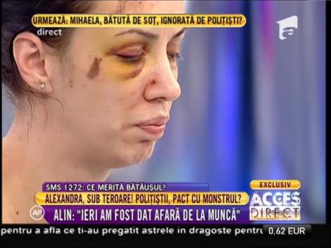 Tânăra snopită în bătaie de fostul iubit: ”Poliția nu m-a ajutat deloc”