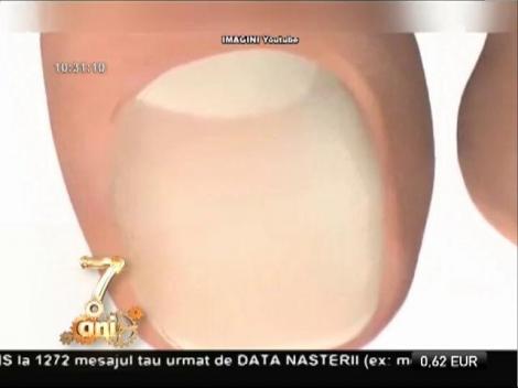 Bună dimineaţa, sănătate! Ce spun unghiile despre sănătate