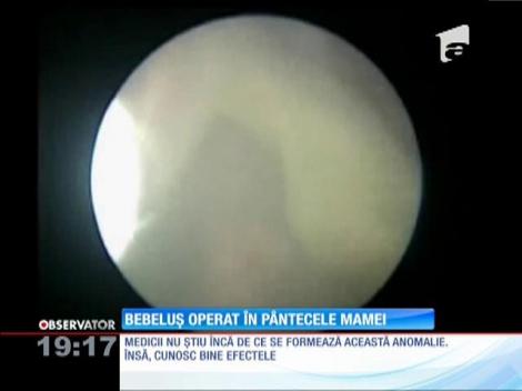 Un bebeluș a fost operat înainte să se nască!