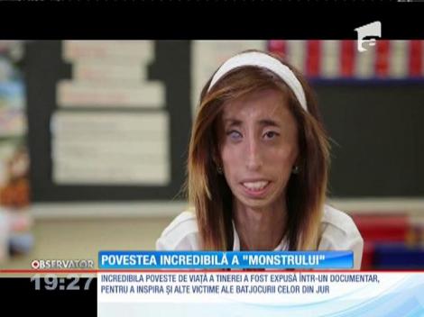 Cea mai urâtă persoană din lume demonstrează că frumuseţea interioară nu este un mit