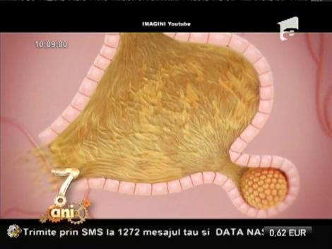 Bună dimineaţa, sănătate! Cum să scapi de coşuri