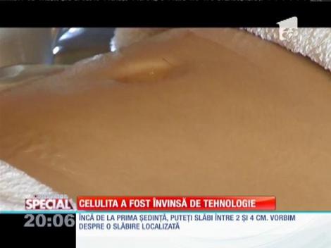 SPECIAL! Celulita a fost învinsă de tehnologie