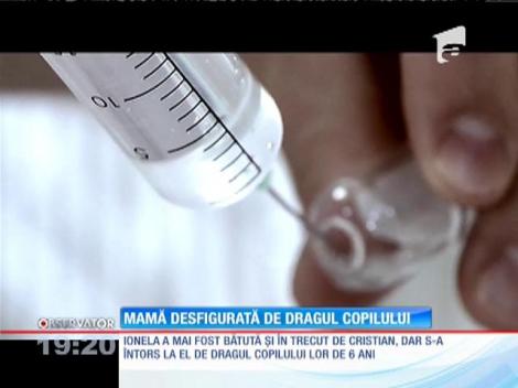 Mama desfigurată de dragul copilului