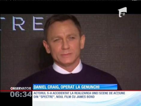 Daniel Craig, operat la genunchi