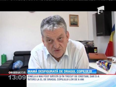 Mamă desfigurată de dragul copilului
