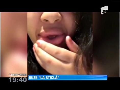Cu o sticlă reuşesc să obţină în loc de buze mari şi senzuale, buze imense şi îngrozitoare