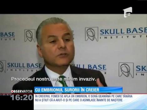 Descoperire macabră! Soră geamănă scoasă din creierul unei femei