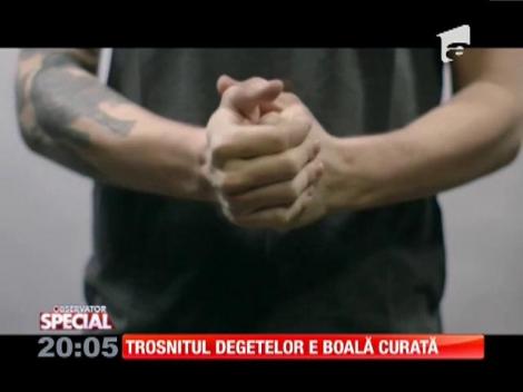 Special! Trosnitul degetelor e boală curată