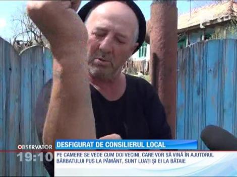 Tânăr desfigurat de consilierul local