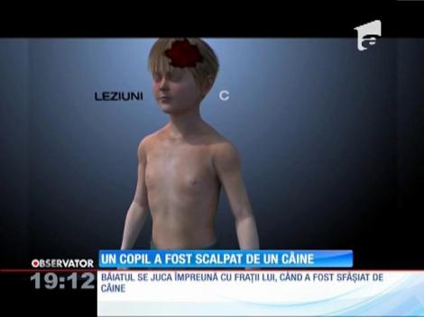 Un copil a fost scalpat de un c&acirc;ine