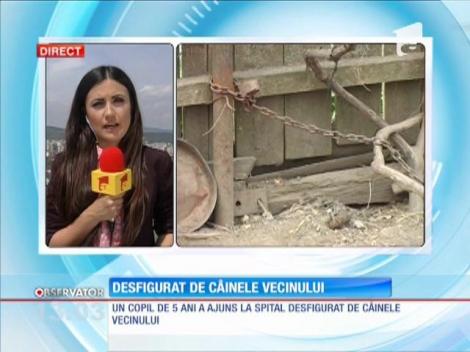 Copil de 5 ani desfigurat de câinele vecinului