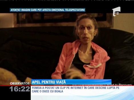 Imagini șocante! Cântăreşte 20 de kilograme la 37 de ani!