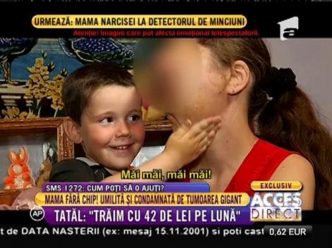 Destin DISTRUS de o tumoră gigant! Mărturisirile CUTREMURĂTOARE ale femeii cu chipul desfigurat