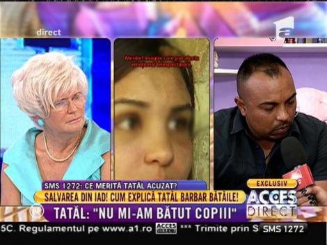 Nu o să-ţi vină să crezi cât tupeu poate să aibă tatăl bătăuş