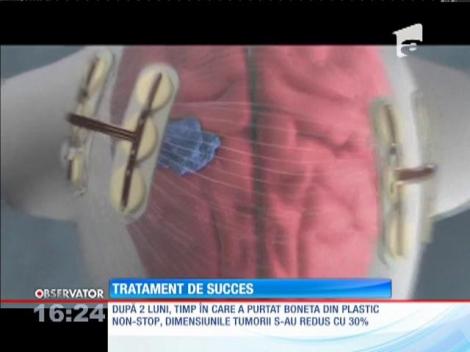 A scapat de cancer cu un dispozitiv medical inedit