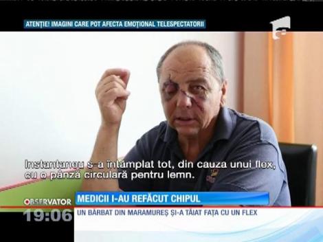 Și-a mutilat fața cu un flex. Medicii i-au refăcut chipul