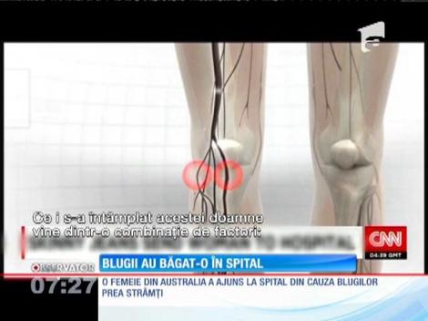 O femeie din Australia a ajuns la spital din cauza blugilor prea strâmți