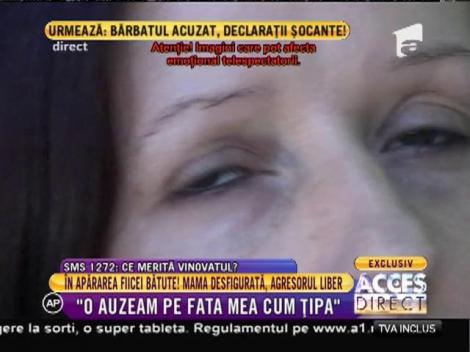 O mamă a fost desfigurată după ce a sărit în apărarea fiicei bătute!