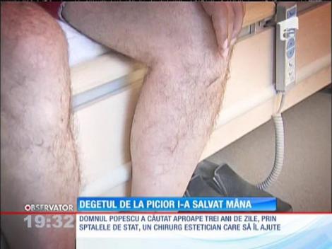 Degetul de la picior i-a salvat mâna