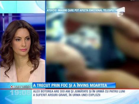 Alex, copilul salvat din foc, a sfidat toate verdictele sumbre ale medicilor