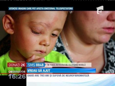 Vreau să ajut! David are 3 ai și suferă de neurofibromatoza