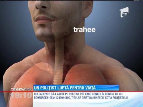 Poliţistul,luat pe capotă, de un şofer de origine turcă, luptă pentru viață