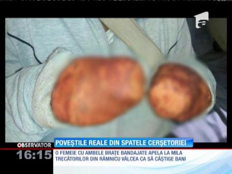 Pentru a primi bani şi-a bandajat ambele mâini ca să dea impresia că sunt tăiate. Cerșetoarea a fost ridicată de jandarmi