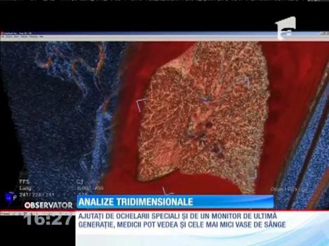 Un program care poate proiecta 3D imaginea organelor umane